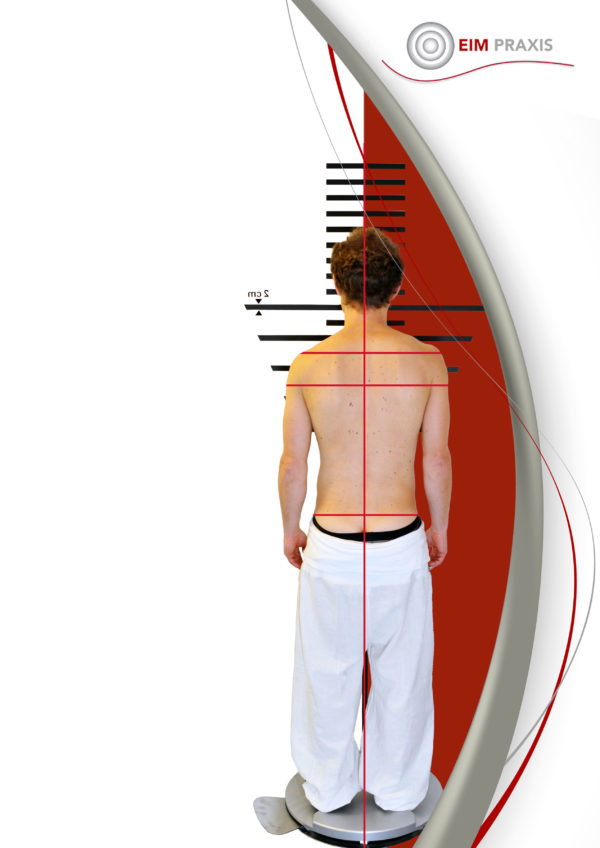 EIM-Atlaskorrektur-Atlas-Korrektur-Atlastherapie-Atlasbehandlung - EIM ...